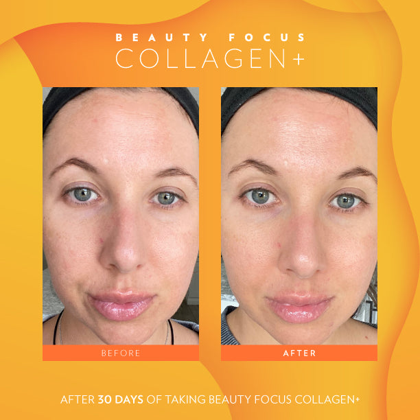 Beauty Focus Collagen+ Before and After 1