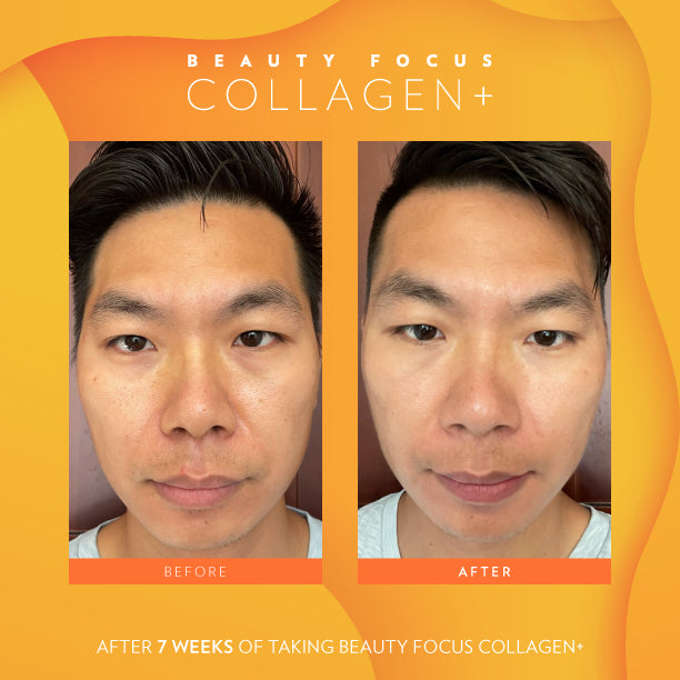 Beauty Focus Collagen+ Before and After 4