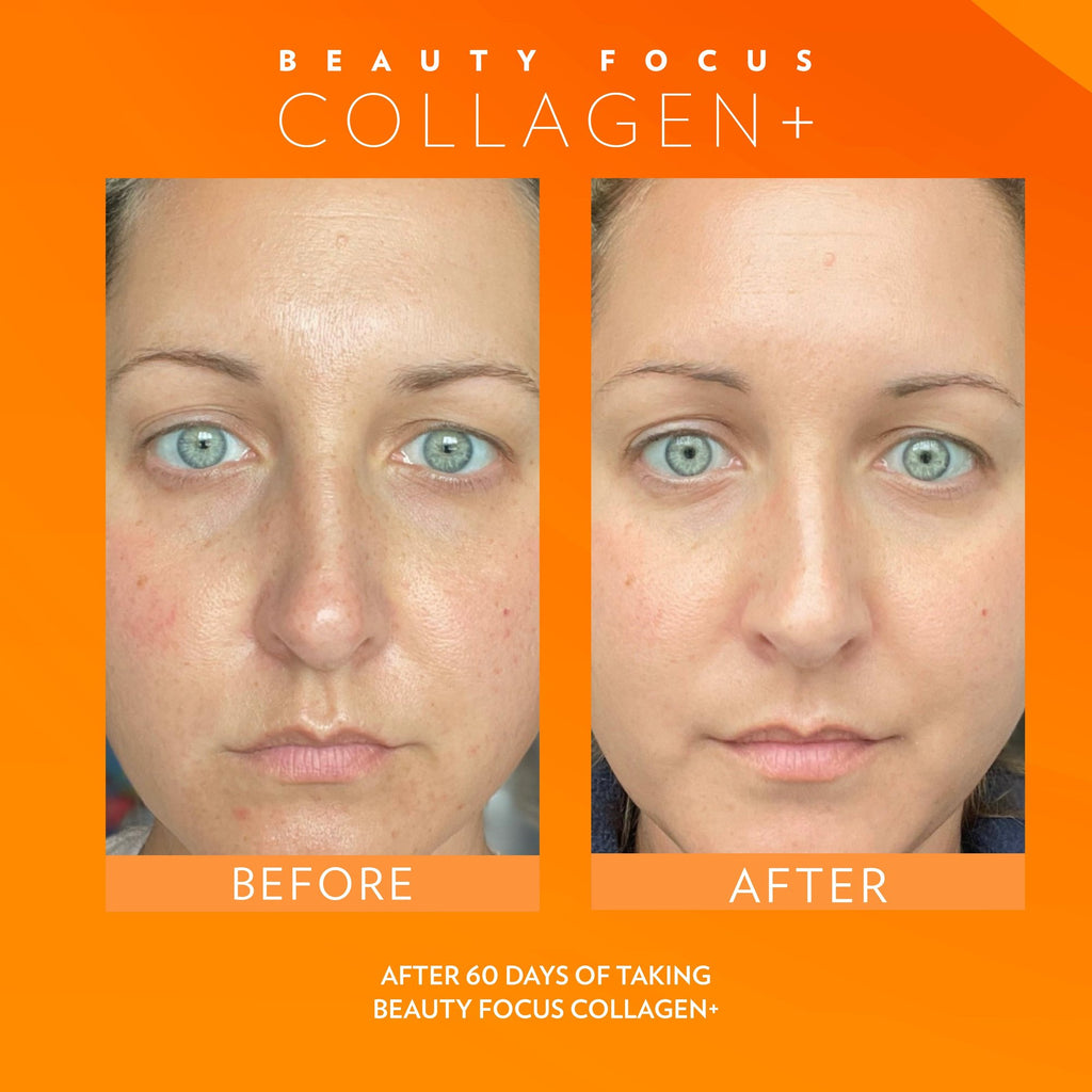 Beauty Focus Collagen+ Before and After Comparison