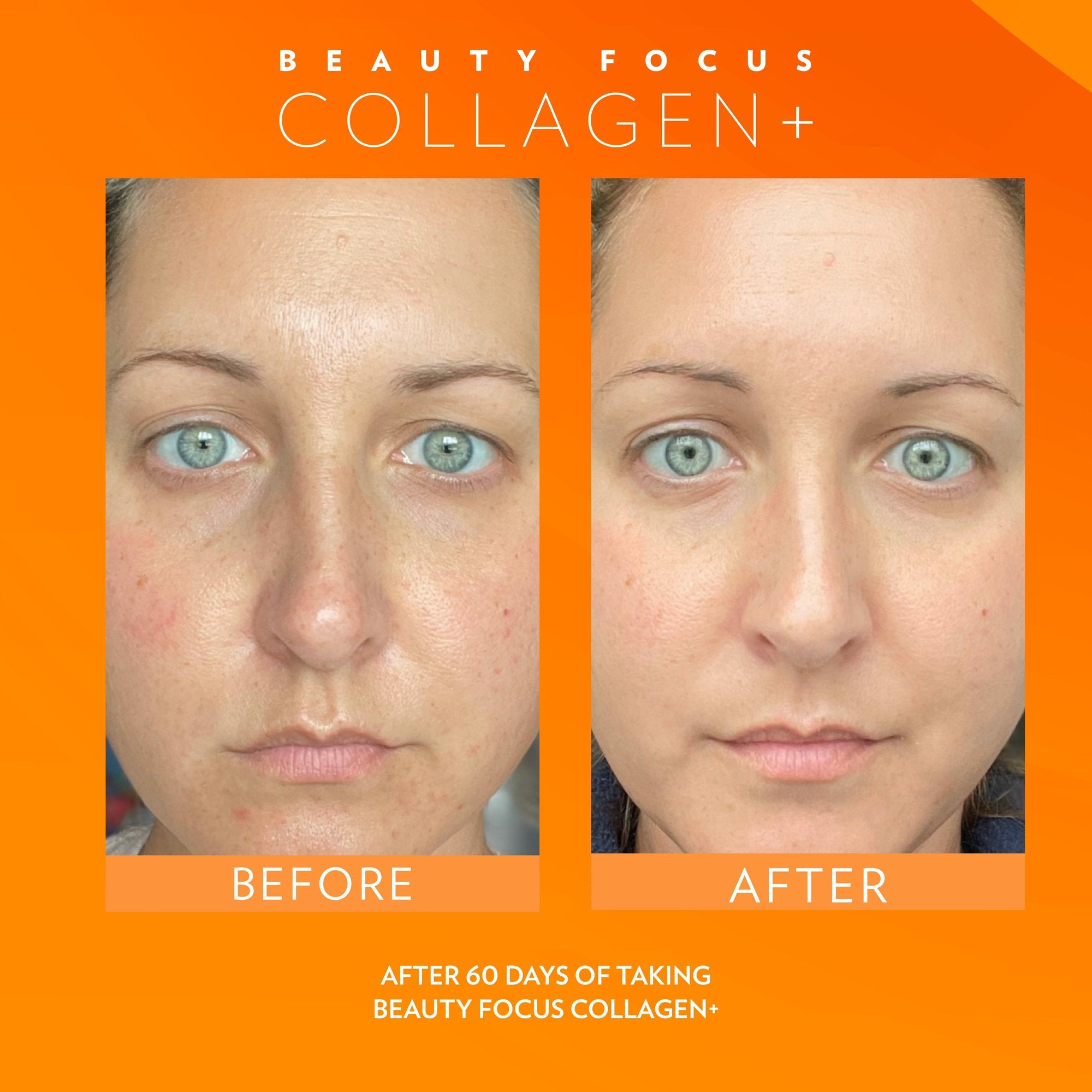 Beauty Focus Collagen+ Before and After Comparison
